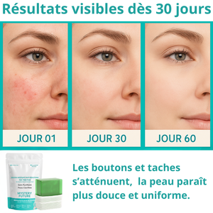 Savon Tea Tree Purifiant Naturel 140g | Nettoyant Profond Anti-Imperfections | Régulateur de Sébum | Visage & Corps | Peaux Grasses, Mixtes & Acnéiques