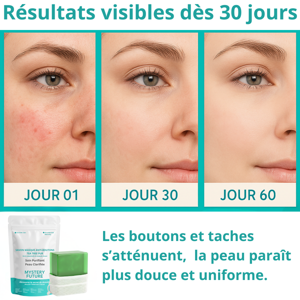 Savon Tea Tree Purifiant Naturel 140g | Nettoyant Profond Anti-Imperfections | Régulateur de Sébum | Visage & Corps | Peaux Grasses, Mixtes & Acnéiques