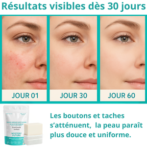 Savon Riz & Acide Kojique | Éclat & Uniformité du Teint | Anti-Taches Pigmentaires | Nettoyant Doux Visage & Corps | Peaux Ternes Hyperpigmentation