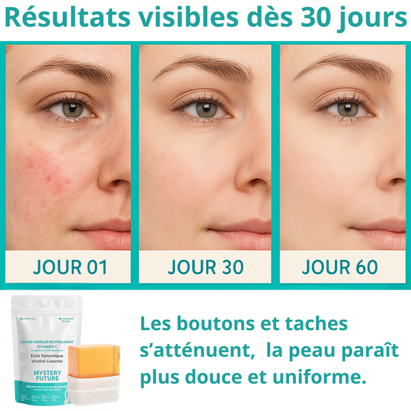 Savon Vitamine C | Éclat & Uniformité du Teint | Anti-Taches & Hyperpigmentation | Éclaircissant Naturel Peaux Ternes | Glow Skin Visage & Corps | 100% Naturel