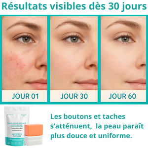 Savon au Soufre | Purifiant & Régulateur de Sébum | Anti-Imperfections Visage & Corps | Peaux Grasses Acnéiques | Nettoyant Clarifiant Profond | 100% Naturel