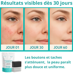 Savon Charbon Actif | Visage & Corps Purifiant Détoxifiant | Nettoyant Profond Peaux Grasses Mixtes Acnéiques | Régule l’Excès de Sébum